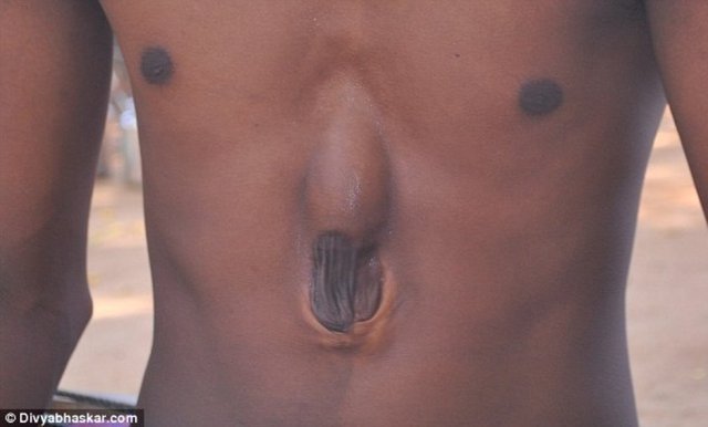 Fakat doktorlar, Gohil'in korumasız kalbine ufak ta olsa bir darbe almasının ölümüne sebebiyet vereceğini söylüyor.