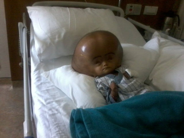 başka çocuklara cevap verebildiğini ve adı söylendiğinde gülümsediğini söyledi.