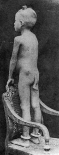 Yapılan araştırmalarda ise dünyada 40 kuyruklu insanın olduğu saptandı. -  -  -  -  -  -