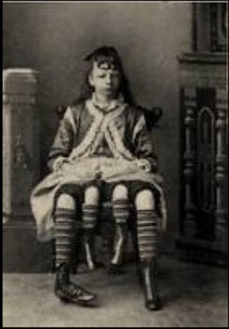 Corbin'in 4 bacağı simetrik değil. İçte kalan bacakları daha küçük. Bir açıklamasında Corbin içteki küçük bacaklarıyla da hareket edebildiğini ancak yürüyüş için zayıf olduğunu söylemişti.