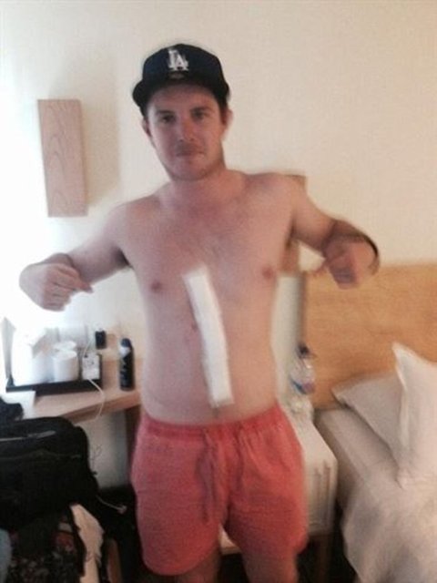 Ancak üç gün sonra kırmızı çizginin su toplaması ve neredeyse boyunun iki katı uzaması sonucu Dylan bir şeylerin ters gittiğini anladı.