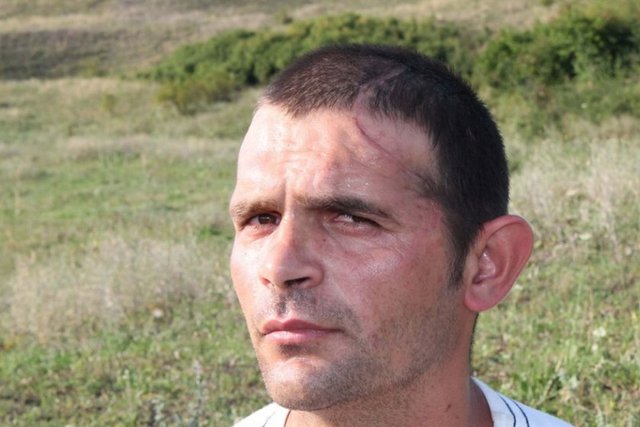 Açılan yardım hesabında kısa sürede gereken bedel toplandı ve genç işçi başarılı bir ameliyatın ardından kafatasının bütününe kavuştu.