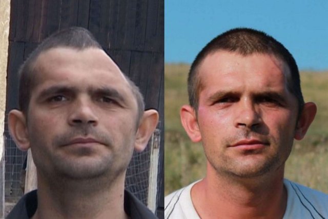 Kafatasının düzeltilmesi için 1400 dolarlık ameliyat masrafını karşılayamayan genç işçinin imdadına Romanya halkı koştu.