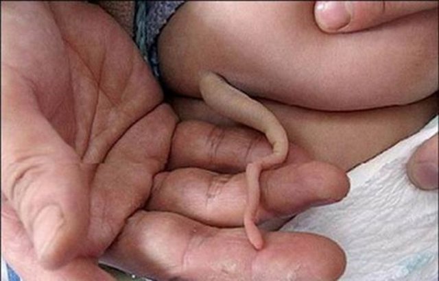 Çok ender de olsa bazı erişkin insanlarda kuyruk kemiğinin on santimetreye varan bir kuyruk oluşturabildiği, bu kuyrukta kas, sinir ve damarların bulunabildiği görülüyor.