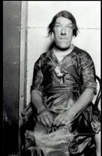 Mary Ann Bevan - 1874'te Londra'da doğdu. Sekiz kardeşten biriydi. 1903'te hemşireyken bir manavla evlendi. Evlendikten sonra akromegali sendromunun belirtilerini göstermeye başladı. -