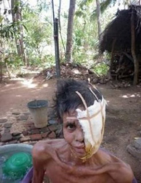 Oğluyla birlikte evin inşaatında çalışan yaşlı kadın, bir gün yanağında bir şişkinlik farketti fakat önemsemedi