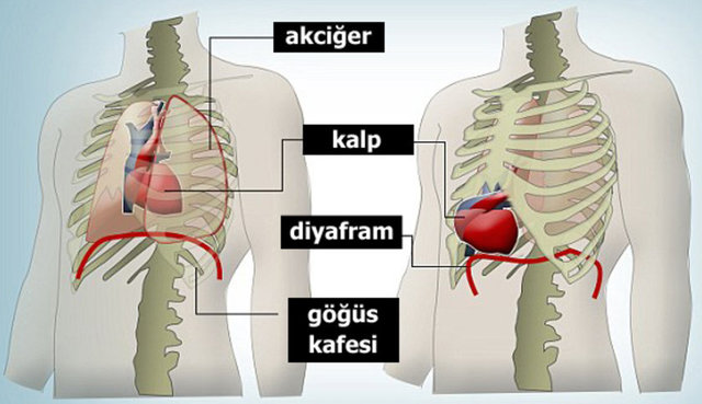 Tıpta 'Ectopia Cordis' adıyla bilinen hastalıkla ilgili bugüne kadar 165 vaka bildirilmiş.