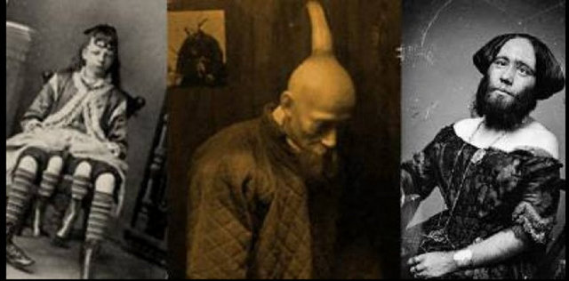 Bu hastalıkları duymadınız - Onlar, fiziksel ve genetik hastalıklardan dolayı diğer insanlardan farklılar.