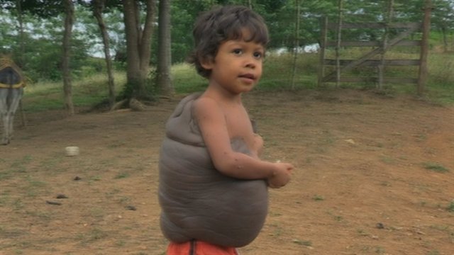 Didier artık büyüyebileceğini çünkü sırtında kocaman beninin olmadığını söylüyor. -  -