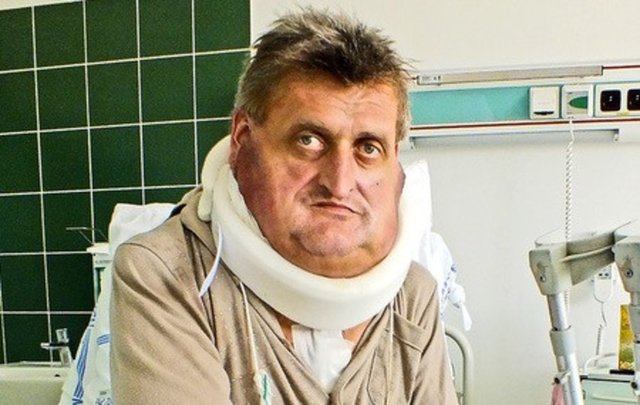 İnsan içine çıkamaz hale gelmiştim. En kötüsü ise artık başımı taşımakta zorlanıyordum...