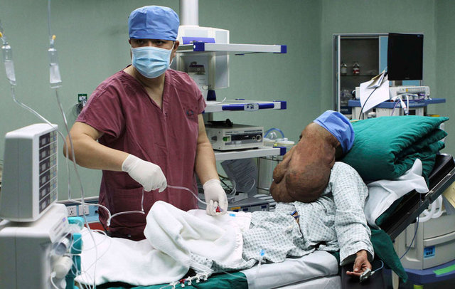 Suratındaki nörofibromatosisin aşırı şişmesinden dolayı tüm suratının şişmesinden ve birçok hayati fonksyonlarını zar zor gerçekleştirmekten şikayet ediyordu. -