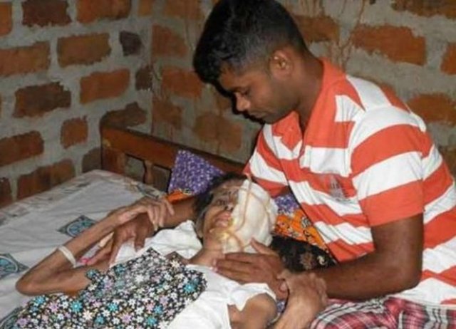 Yaşlı kadına Amerika'da tam yüz nakli yapılacak.