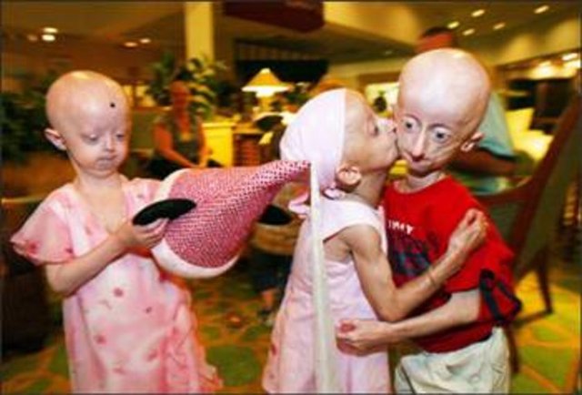 Progeria'ya bir çocuğun genetik şifresindeki ufacık, basit bir kusur neden olabilir ama yıkıcı ve hayatını değiştiren sonuçlara yol açar.