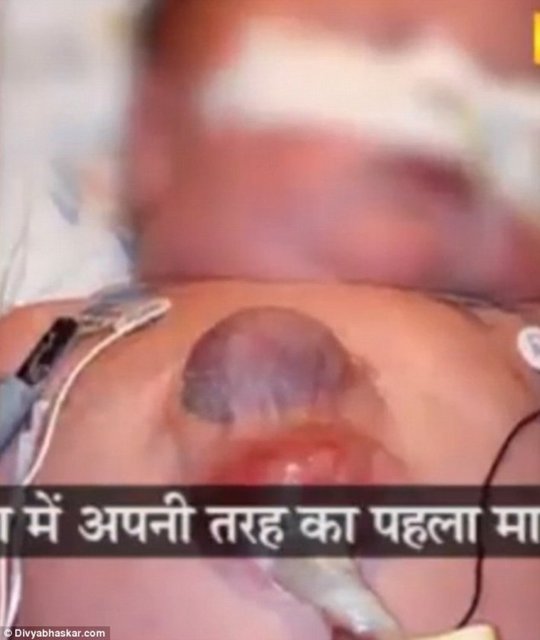 Doğduğu zaman doktorlar, Gohil'in fazla yaşayamayacağını söylemesine rağmen genç adam 18. yaş dönümünü kutluyor.