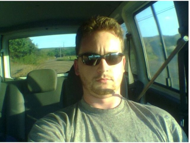 Fotoğrafta gördüğünüz adam başına gelenin şokuyla bu fotoğrafları çekti, internette rekor kırdı. Çünkü hayatta kalması bir mucize.