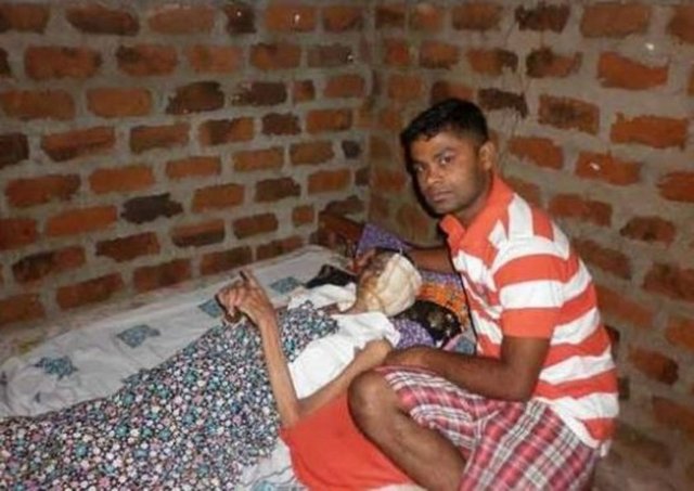 Kadının durumunu öğrenen ABD'deki bir hastane, kadına yüz nakli yapacağını açıkladı