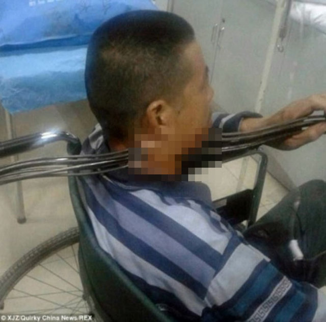 Doktorlar Xie Mo'nun aldığı büyük yaralara rağmen iyileşeceğini bildirdi.