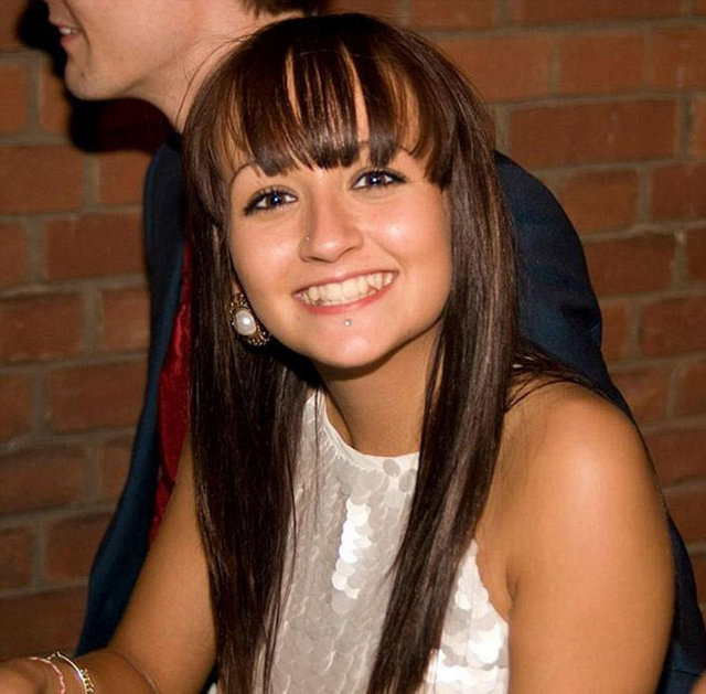 Cildi soyulan Leanne Howes yüzünün, omzunun ve göğsünün büyük bir bölümündeki derileri kaybetti.