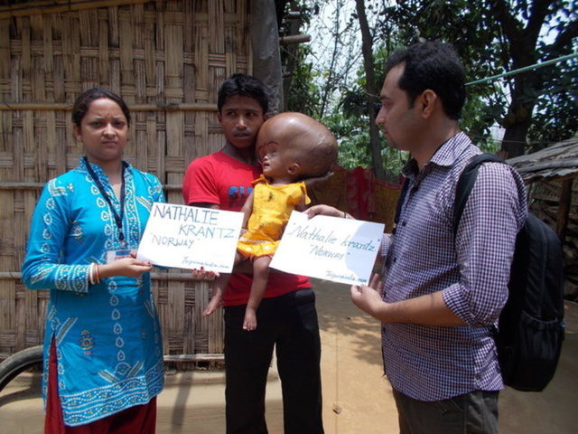 Üç yaşındaki Roona Begum, geçen yıl Hindistan, Yeni Delhi'de beynindeki su toplanmasından kaynaklanan büyüklük nedeniyle hastaneye kaldırılmıştı.
