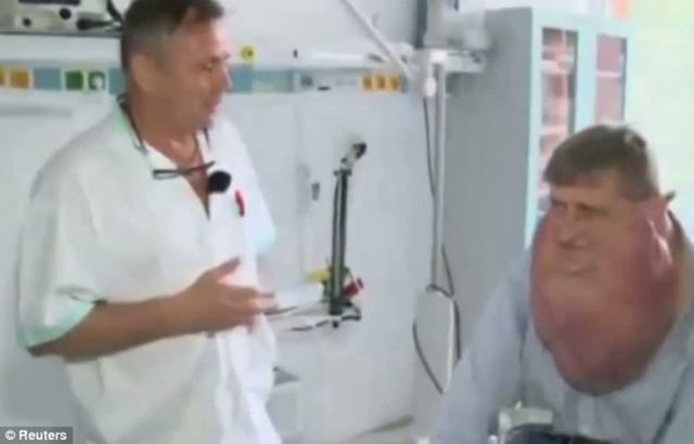 Ameliyatı yapan Dr. Igor Homola, "Çok az rastlanan bir tümör tipi olan yüz tümörlerinin büyüme hızı şaşırtıyor...