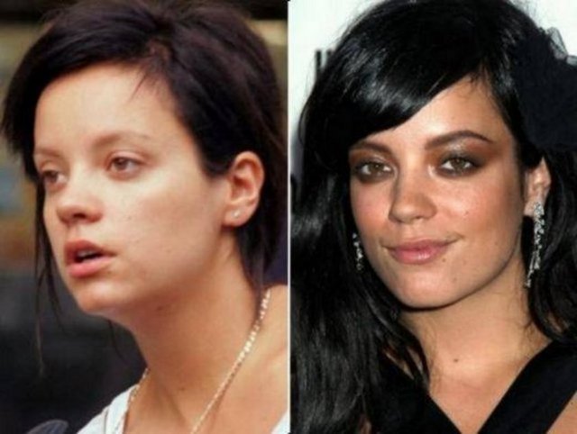 Lily Allen