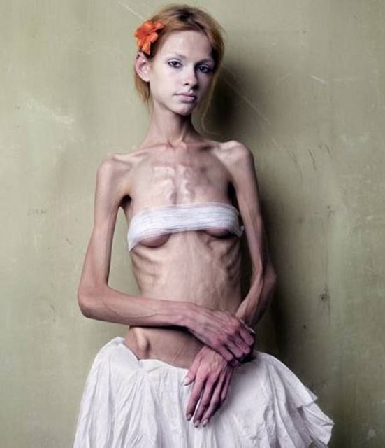 фото очень худые девушки скелеты обтянутые кожей база