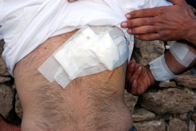 Kolundan ve sırtındaki 5 yerinden aldığı pençe darbesiyle yaralanan Kaplan, tedavinin ardından taburcu edildi.