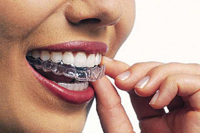 Takma damak ve diş tellerinin düzenli olarak temizlenmesi şarttır.