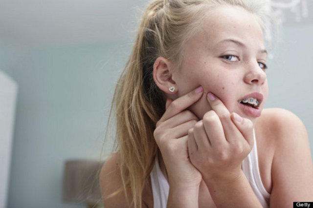 Sivilcerinizle tamamen yanlış bir şekilde mücadele ediyorsunuz! -  -  -  -  -  -  -  -