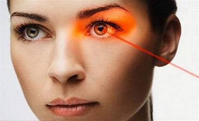 İşlem, korneadan 'Mikrokeraton' adı verilen bıçak yardımıyla kapağın kaldırılması ve içerisine lazer uygulandıktan sonra kapatılması esasına dayanıyor.