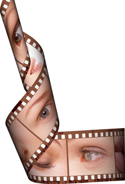 Bu cerrahi sonrası genel olarak yüzde 20 - 25 ve üzeri görme keskinliğine erişmenin mümkün olduğu belirtiliyor. -