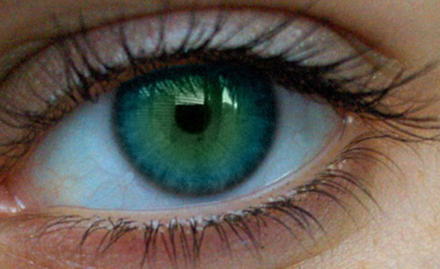 * Sjogren sendromu, romatoid artrit, lupus gibi romatizmal hastalıkları olanlar ile kuru göz sendromu bulunanların lazer göz tedavisi için uygun aday olmadıkları belirtiliyor.