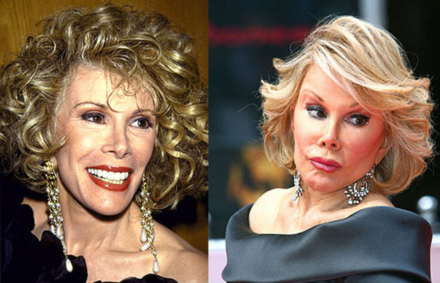 Joan Rivers
