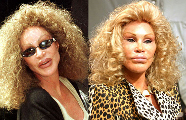 Jocelyn Wildenstein