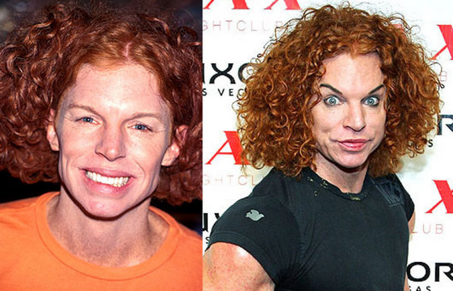 Carrot Top