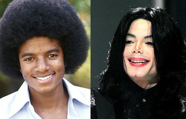 ÜNLÜLERİN ESTETİK FACİALARI  Michael Jackson