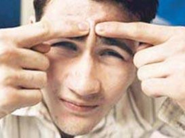 Ergenlik sivilcesi: Erkeklerin sivilce sorunu daha fazladır. Bu da daha çok testosteron hormonundan kaynaklanmaktadır. Bu hormon yağ bezlerini uyarır ve derideki gözeneklerin tıkanmasına, dolayısıyla da sivilceye neden olur.