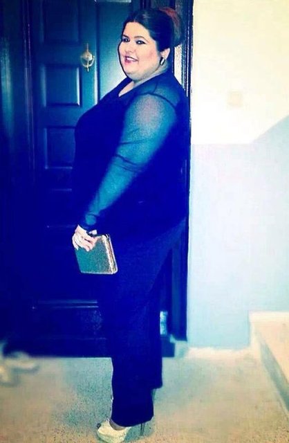 1 YILDA ERİDİ - 27 yaşındaki Funda Turna, azmi ve tıbbi destek sonunda 1 yılda 65 kilo verdi.