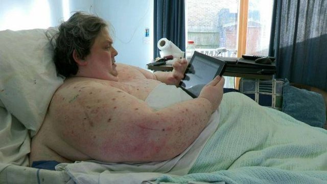 Sağlıklı bir insanın vücut kitle endeksinin 18,5 24,9 arasında olması gerektiğini düşününce bu çok yüksek bir rakam.