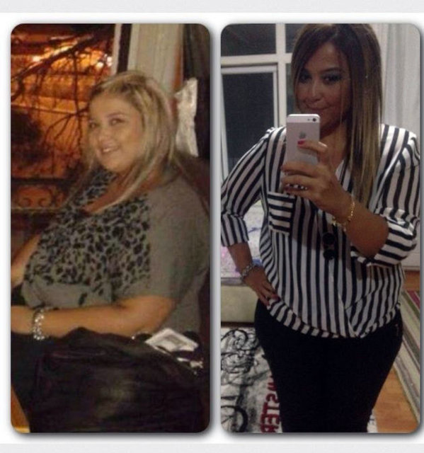 Ameliyat için araştırma yapan Duygu Oturak, Fatih Sultan Mehmet (FSM) Eğitim ve Araştırma Hastanesi'ne başvurdu. Genel Cerrahi Uzmanı Dr. Ahmet Başkent'e muayene olan Oturak'a tüp mide ameliyatı yapılmasına karar verildi.