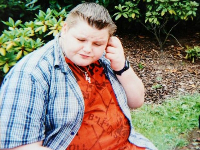 Nathan Hewitt, bu fotoğraf çekildiğinde 15 yaşındaydı.  Ve o dönem kendini İngiltere'nin 'en şişman çocuğu' olarak tanımlıyordu..