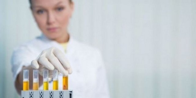 Kanserde erken tanının önemini büyüktür. Hastalığın tanısının konmasının uzaması ile kaybedilen zaman, bazen bireyin sağlığını tehdit edecek boyutta olabilir.