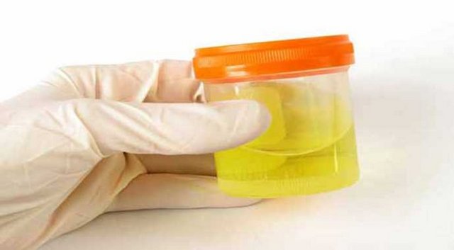 İSKELET SİSTEMİ: - Ele gelen kitle veya şekil bozukluğu, - Kemiklerde şiddetli ağrı, - Hareket kısıtlılığı varsa