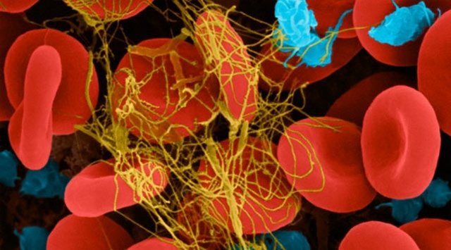 Ancak bu bitki kanın pıhtılaşmasının bozulmasına neden olur. Cerrahiden en az 36 saat önce kesilmelidir.