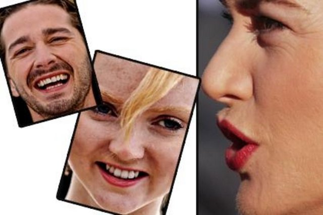 İşte yıldız gibi parlayan ünlülerin gerçek yüzleri...