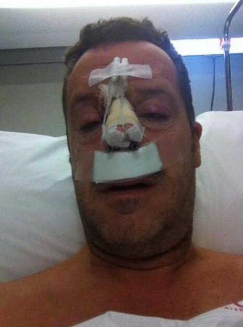 Petek Dinçöz'den olaylı bir şekilde boşanan ünlü yapımcı Can Tanrıyar, Etiler'de saldırıya uğradı. Saldırı sonrası burnu kırılan Tanrıyar ameliyat edildi