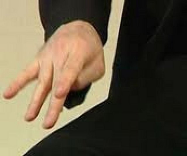 Ellerde titremenin duruş ve harekete göre değişik tipleri vardır. Titreme istirahatte, hareket sırasında, yer çekimine karşı duruşta (eller öne uzatılmış halde) veya bir olaya özel olarak (örneğin; yazı yazma) ortaya çıkabilir.