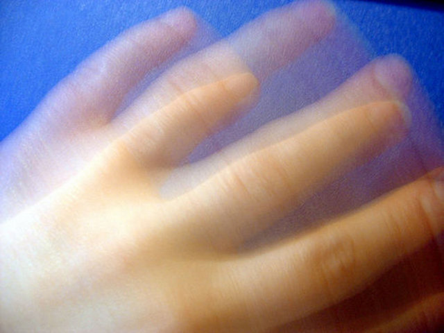 Hastalığın başlangıcında hareket ile titreme kaybolur. İlerleyen dönemlerde titreme daha bariz bir hal alır ve diğer elde, vücudun diğer kısımlarında da görülebilir. Bu hareket sırasında da olabilir.