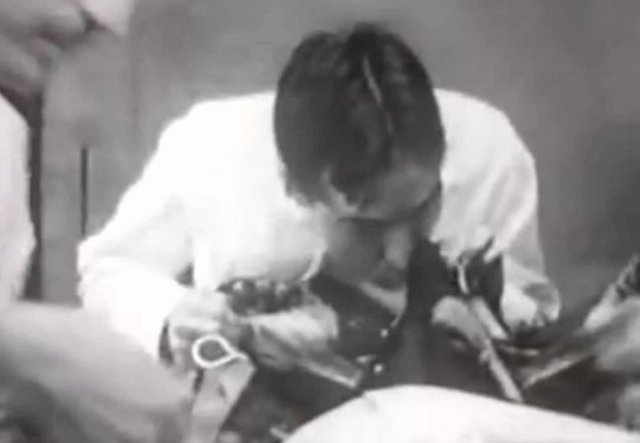 Ardından onları tahterevalli tekniğiyle hayata döndürmeye çalıştı, bazı denekler ağır beyin hasarı, bilinçsizlik ve körlükle hayata döndürülseler de, çok yaşayamadan öldüler.