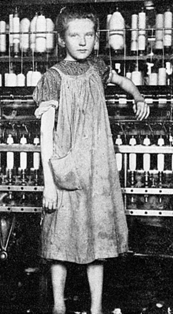 Sonuçlar gösterdi ki negatif davranılan çocuklar psikolojik anlamda çok ağır hasarlar aldılar. Ancak bundan çok daha kötüsü, terapi öncesi konuşma bozukluğu göstermeyen çocukların da konuşmalarında bozulmalar olmasıydı.